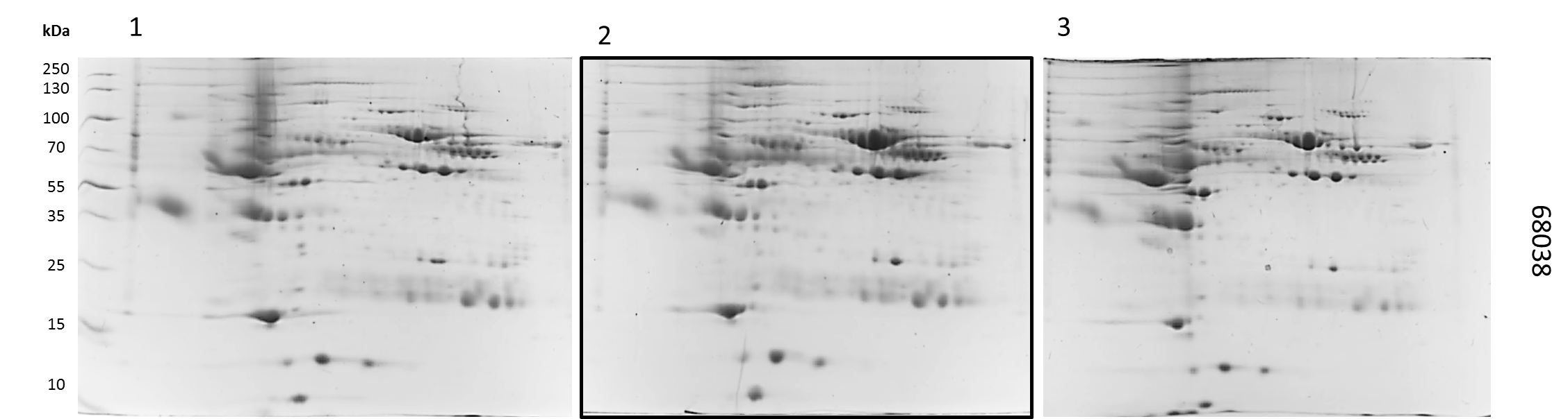 Perfil Electroforetico bidimensional de la muestra 68038.png