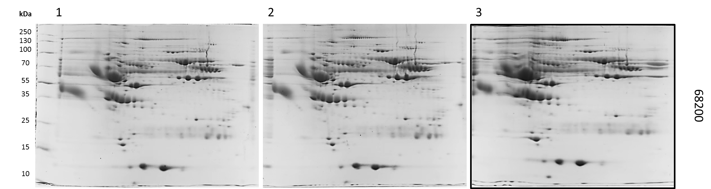 Perfil Electroforetico bidimensional de la muestra 68200.png