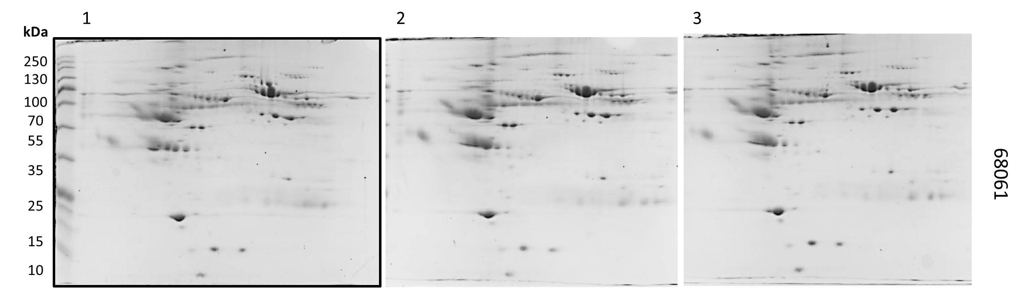 Perfil Electroforetico bidimensional de la muestra 68061.png
