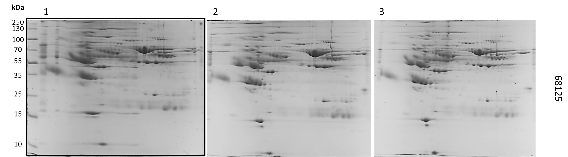 Perfil Electroforetico bidimensional de la muestra 68125.png
