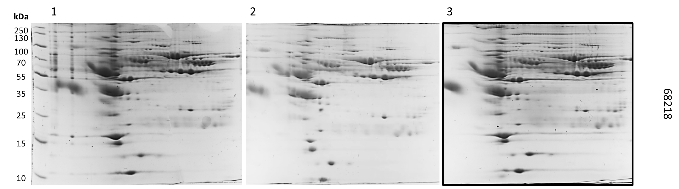 Perfil Electroforetico bidimensional de la muestra 68218.png